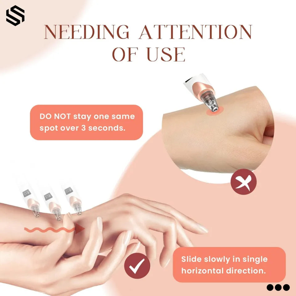 5-in-1 Blackhead Removal Machine - Derma Suction Acne Pore Cleaner, Vacuum Tool, Rechargeable Oil & Whitehead Remover, Multi-Functional Facial Beauty Device